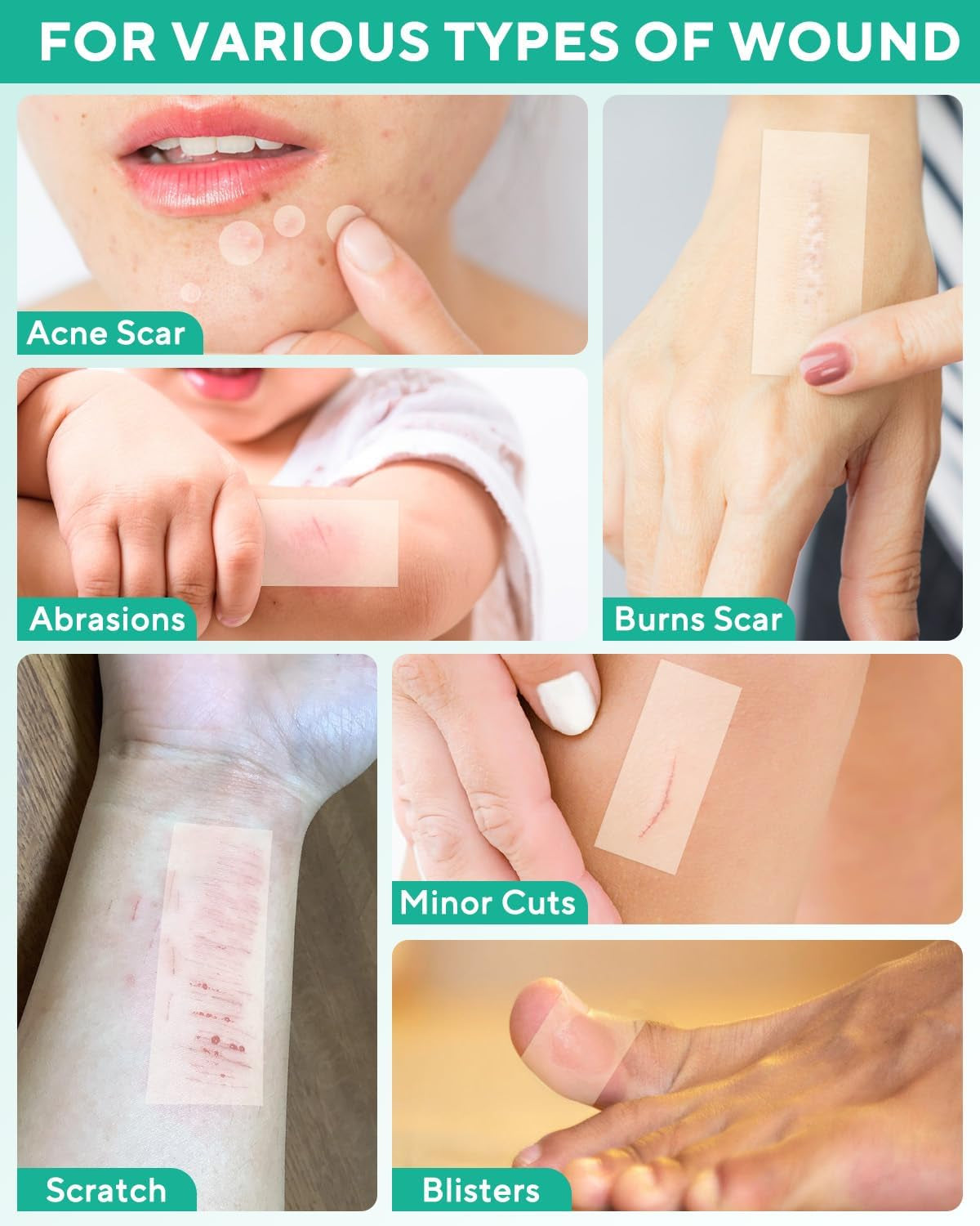 Hydrocolloid Roll for Wound Care, Cut-To-Size Hydrocolloid Bandages